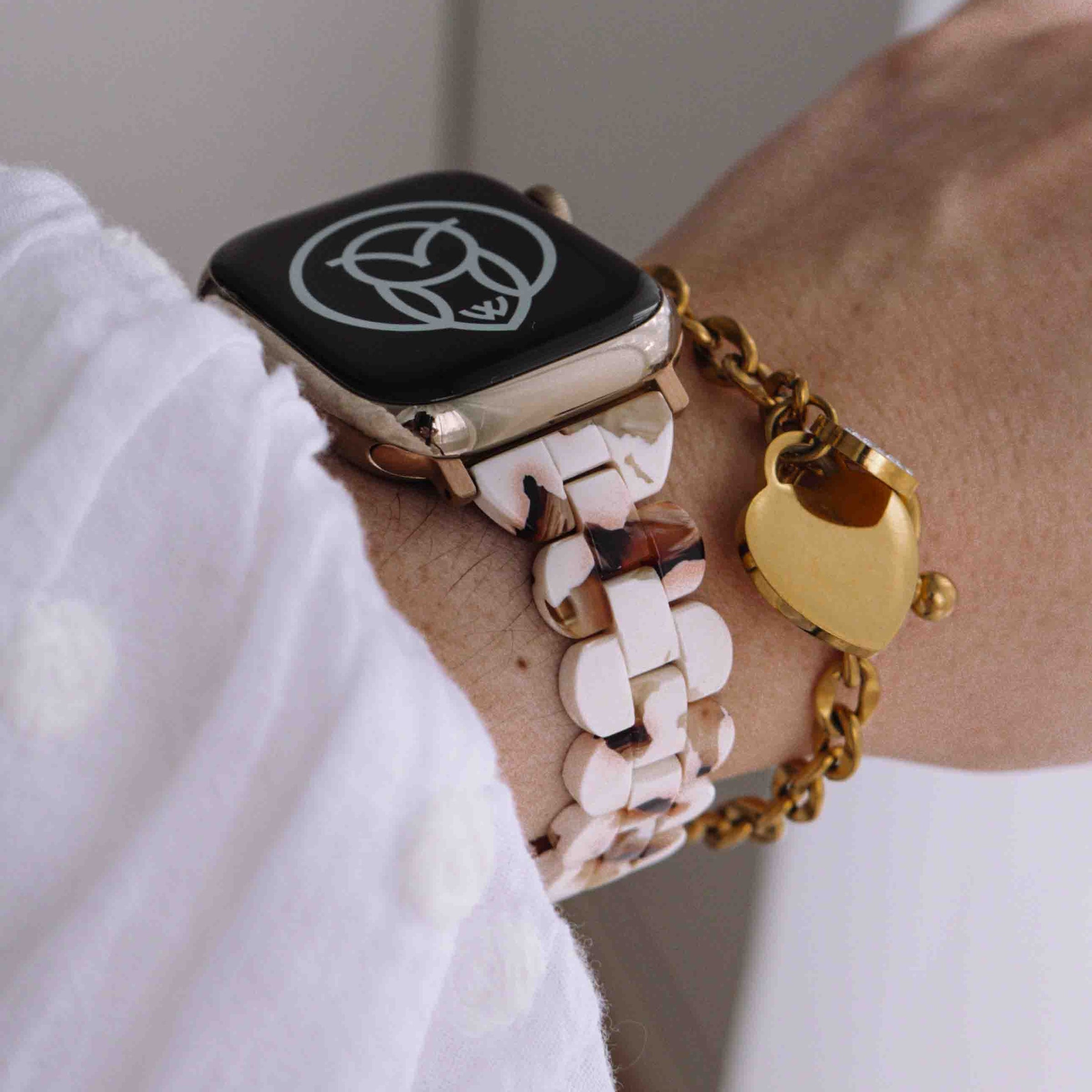 Affordable Quality: The Best Value-for-Money Apple Watch Straps